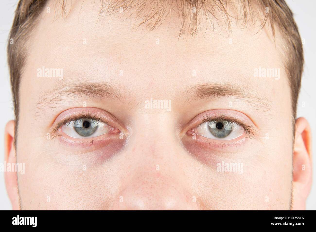 Man's tired gray eyes clean skin Stock Photo