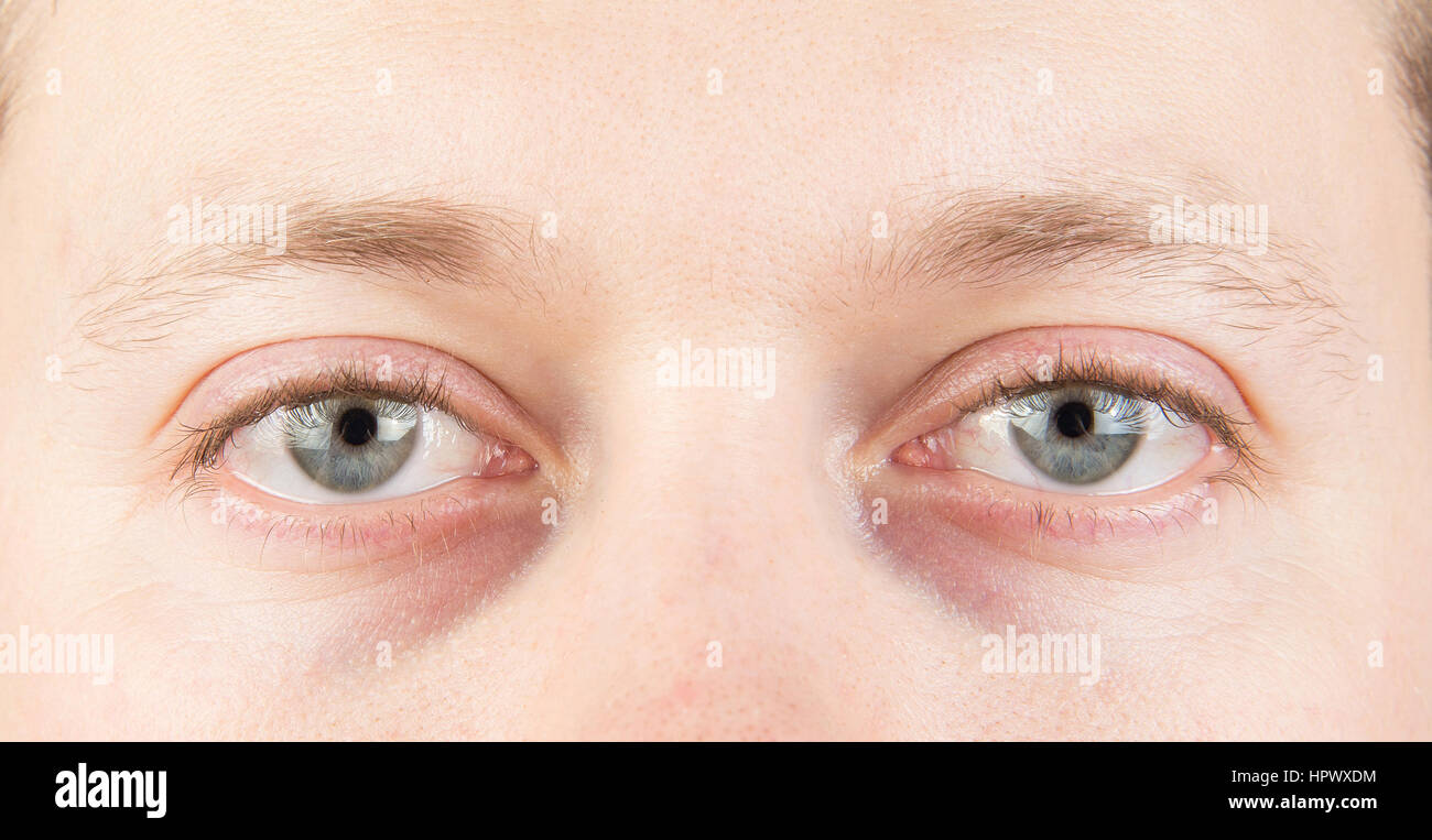 Man's tired gray eyes close up Stock Photo