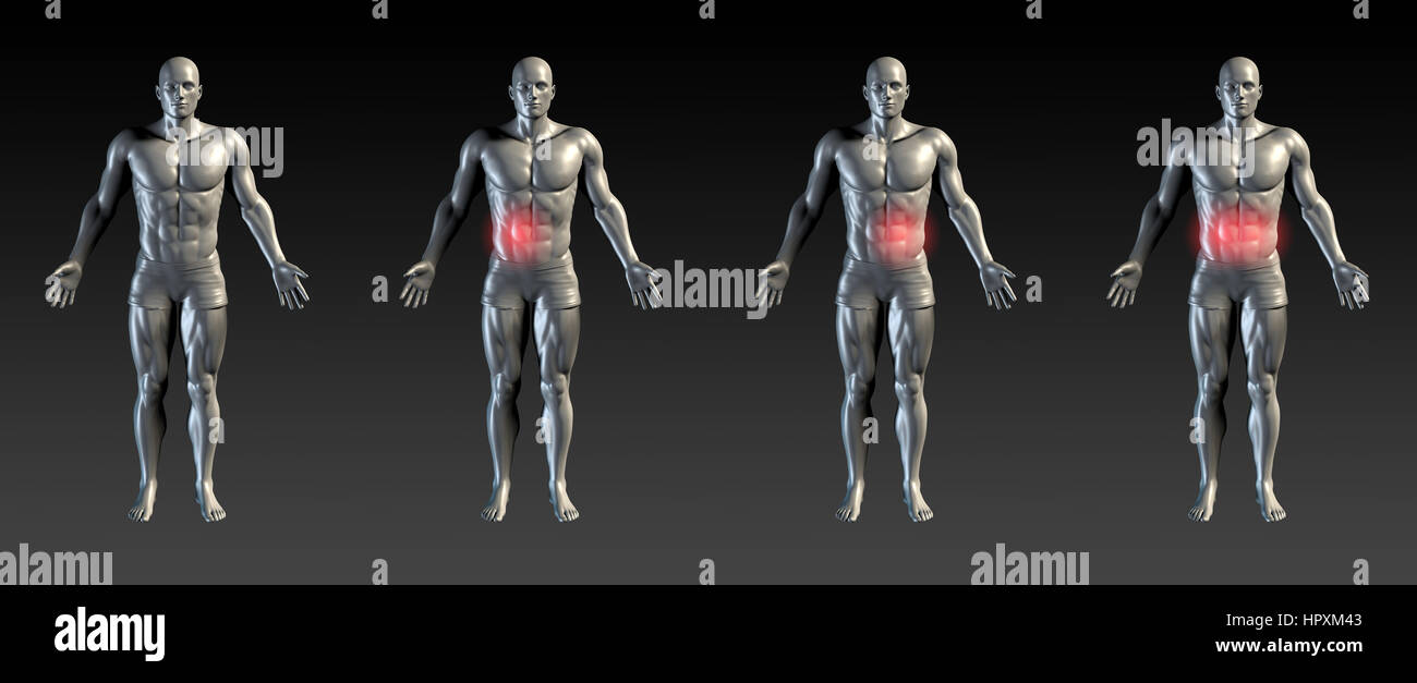Abdominal injury hi-res stock photography and images - Alamy