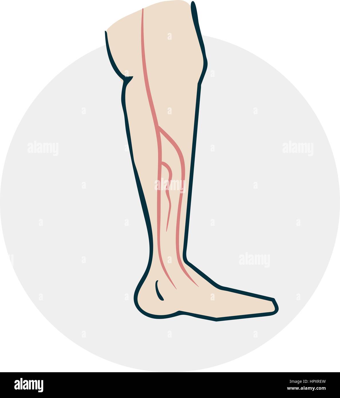 Leg with varicose veins. Drugs Icon on medical subjects. Illustration of a  funny cartoon style Stock Vector Image & Art - Alamy