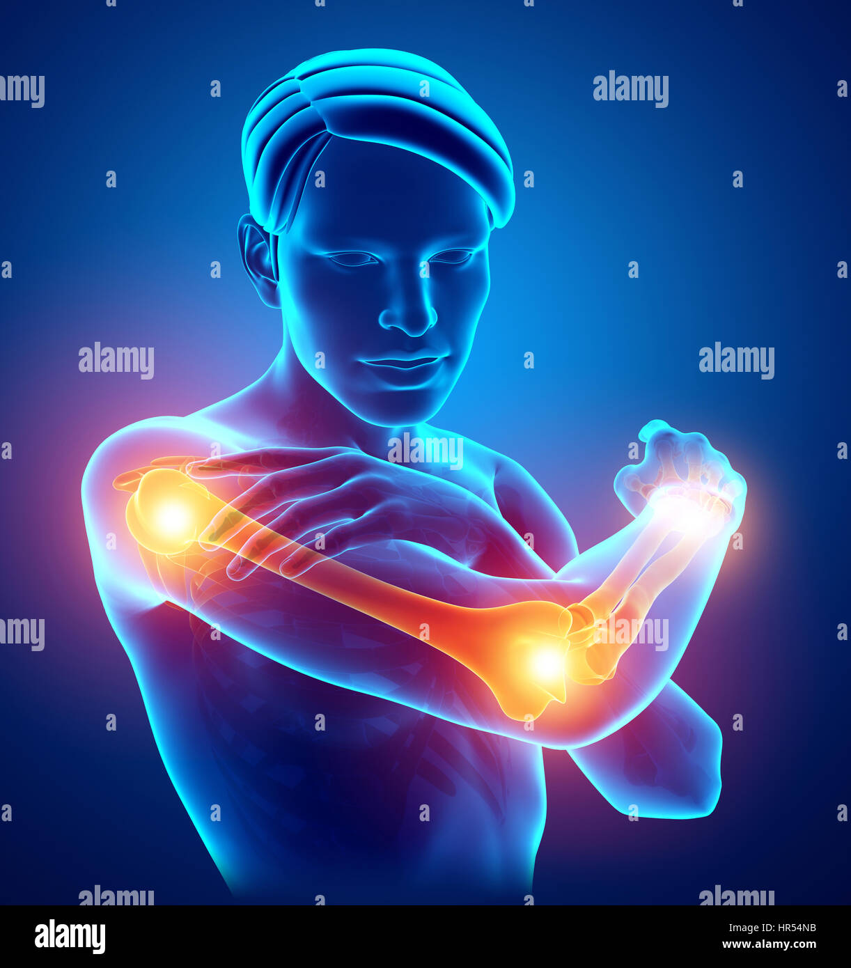 3d Illustration of Men Feeling Arm joint pain Stock Photo Alamy