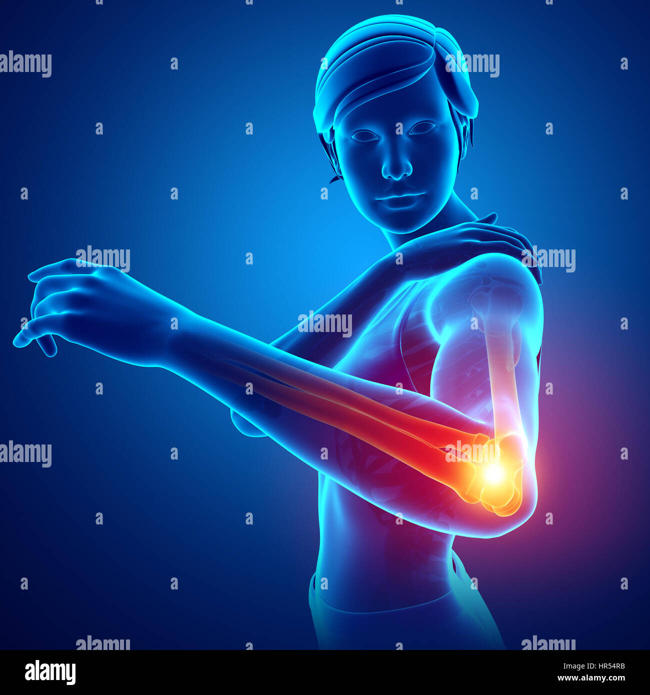 3d Illustration of Women Feeling Elbow pain Stock Photo Alamy