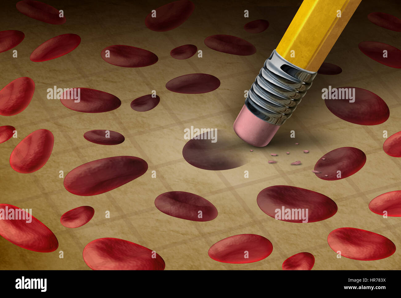 Blood disorder medical concept as a pencil erasing human cells as a medicine hematology symbol for anemia or hemophilia as a 3D illustration. Stock Photo