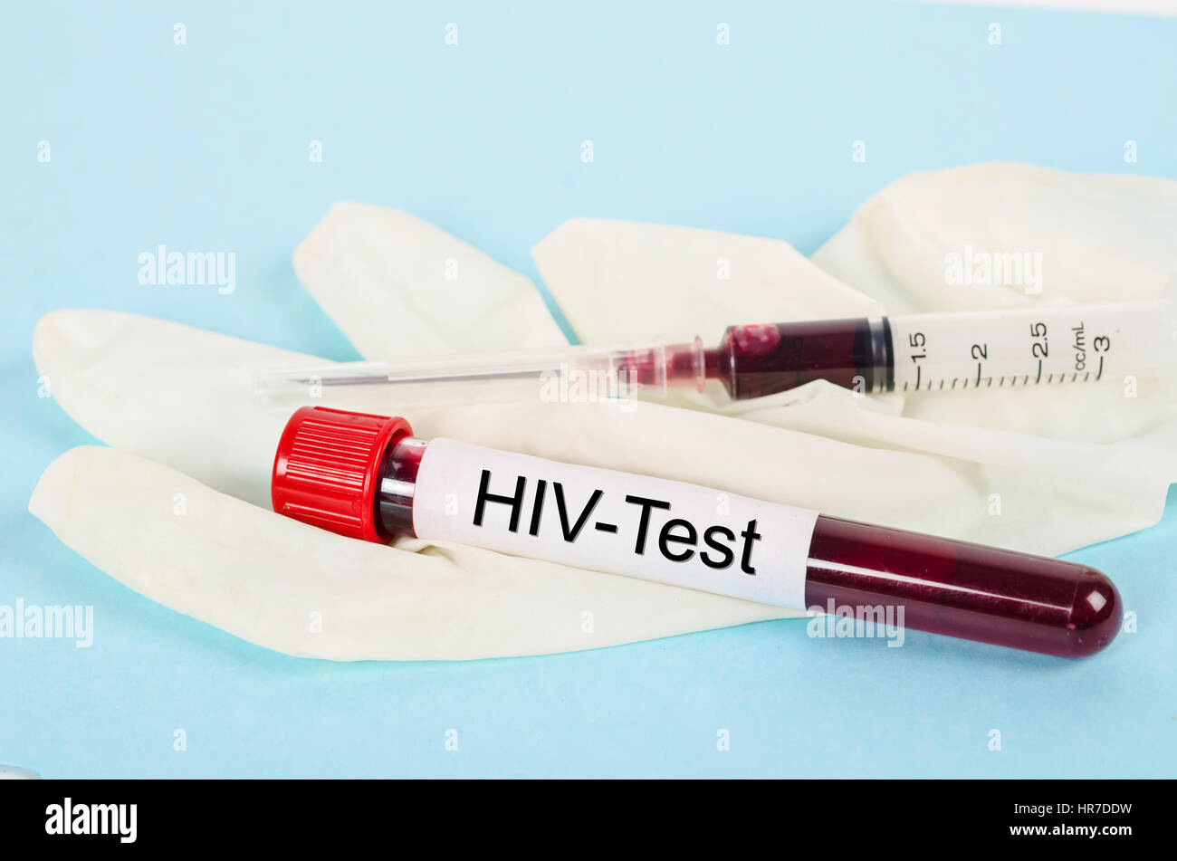 Sample blood collection tube with HIV test label in laboratory. Stock Photo