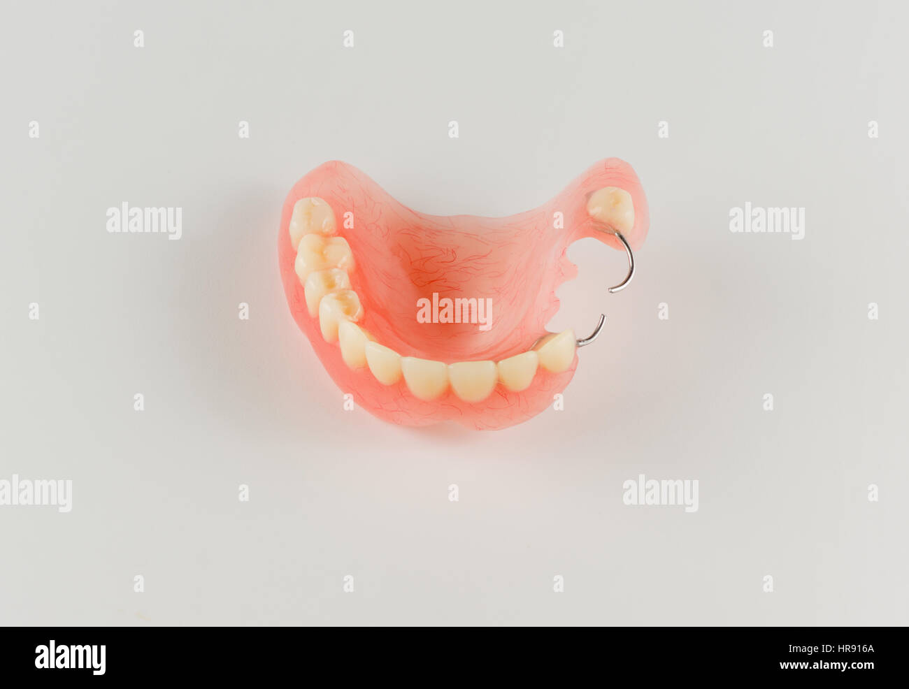 acrylic denture with metal clasps for restoring dentition Stock Photo