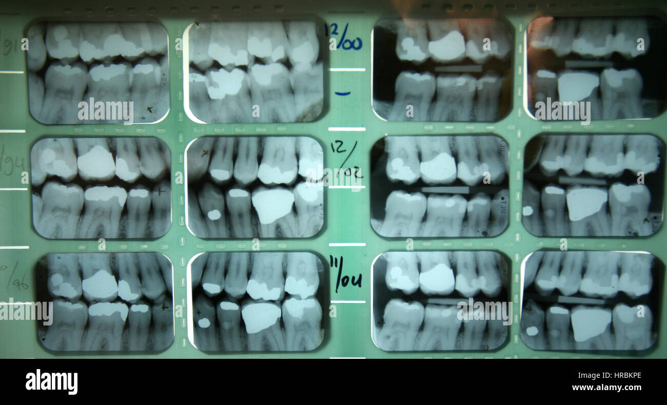 dentist at work in the netherlands Stock Photo Alamy