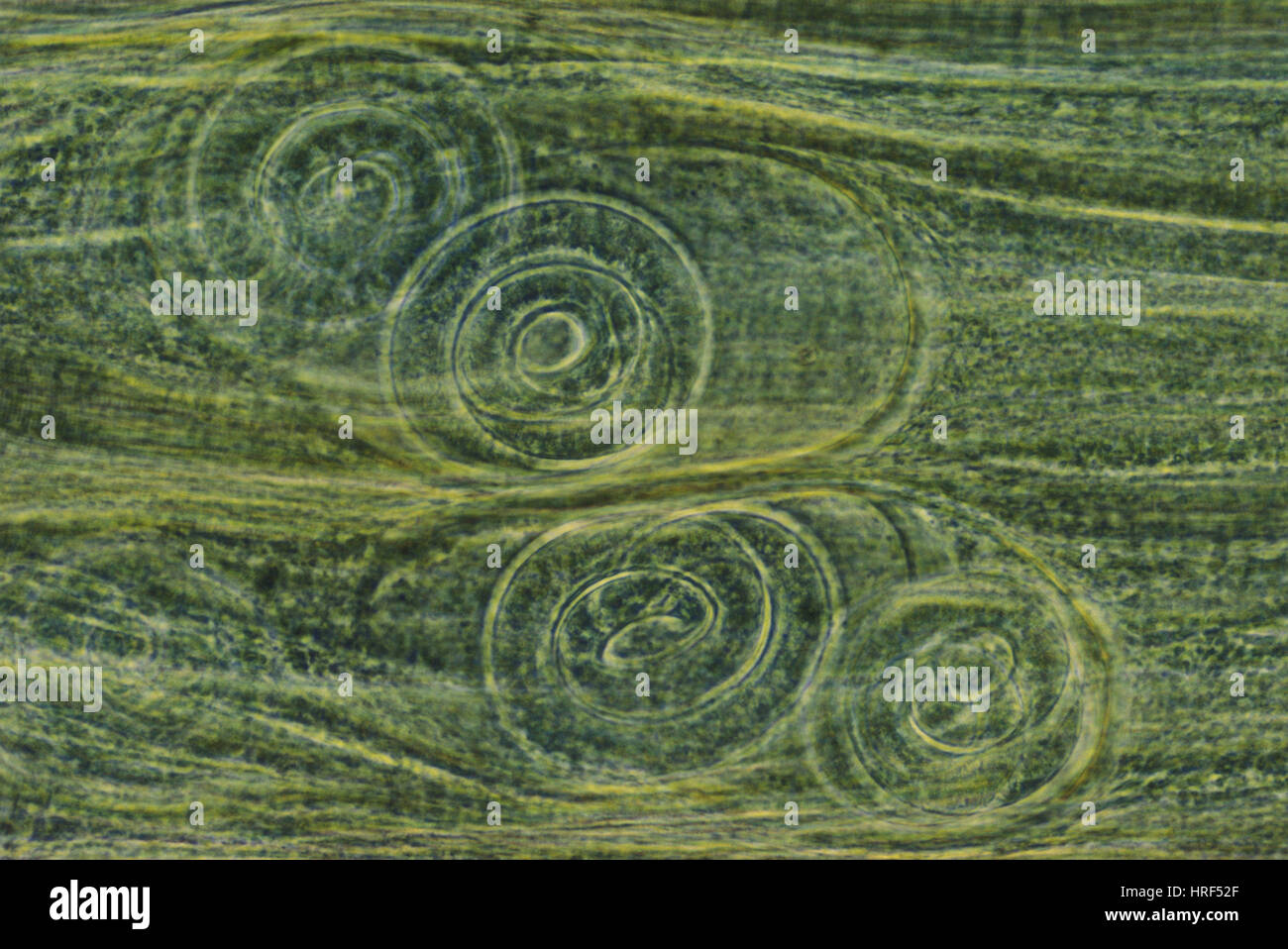 Trichinella spiralis (LM) Stock Photo
