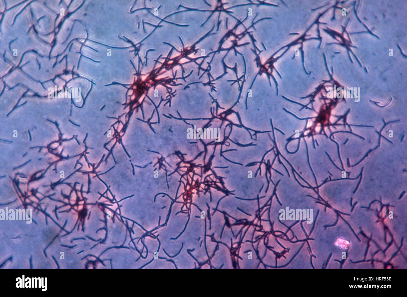 Lactobacillus acidophilus