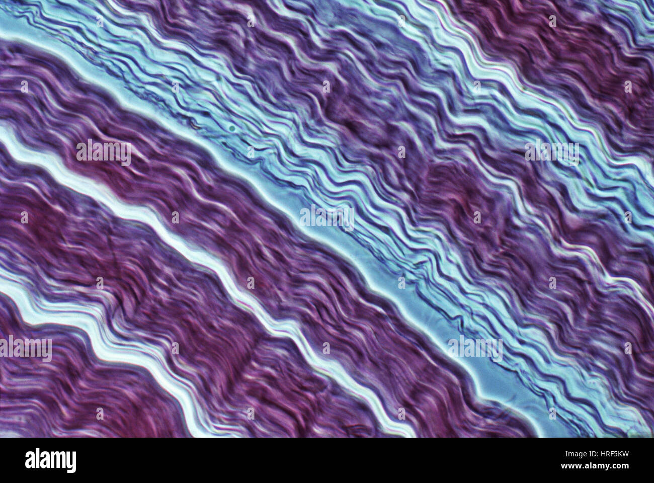 Fibrous connective tissue hi-res stock photography and images - Alamy