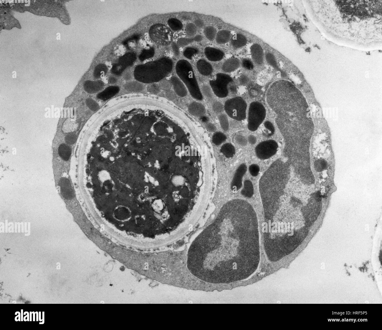 Lymphocyte Digesting Yeast Cell (TEM) Stock Photo