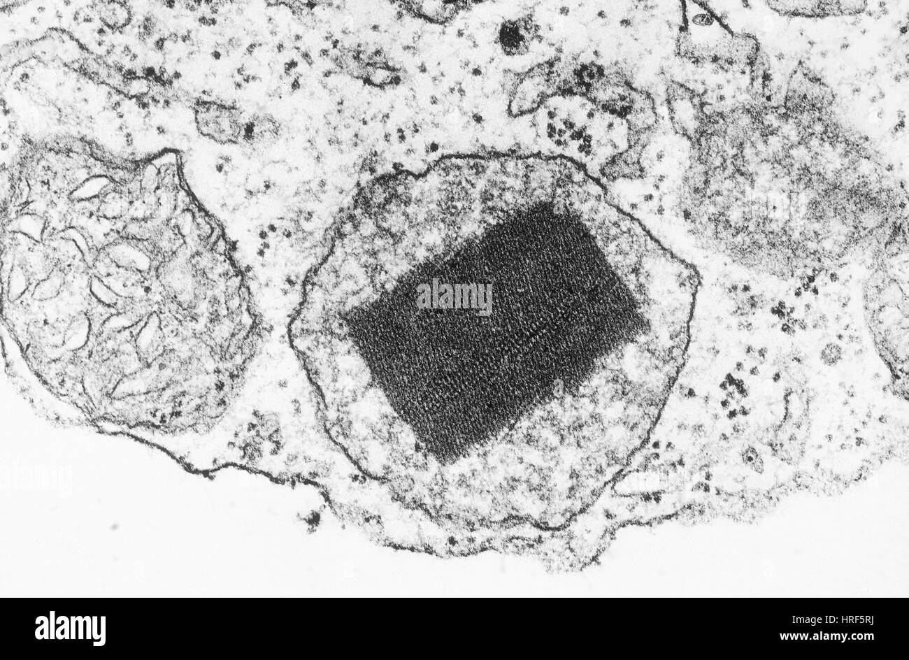 Peroxidase, TEM Stock Photo