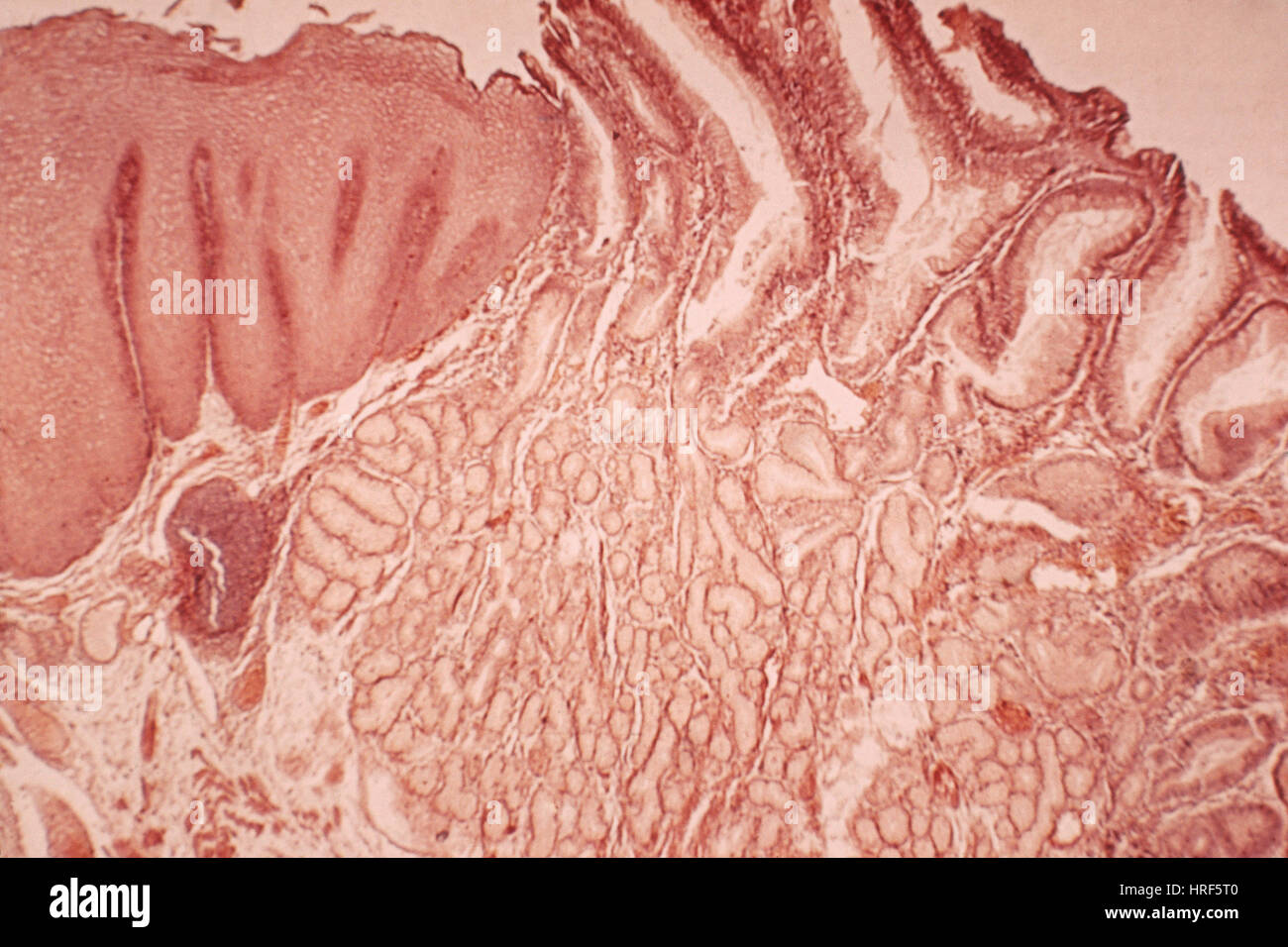 Cardia hi-res stock photography and images - Alamy