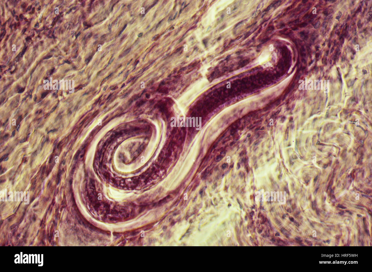 Trichinella Spiralis Stock Photo