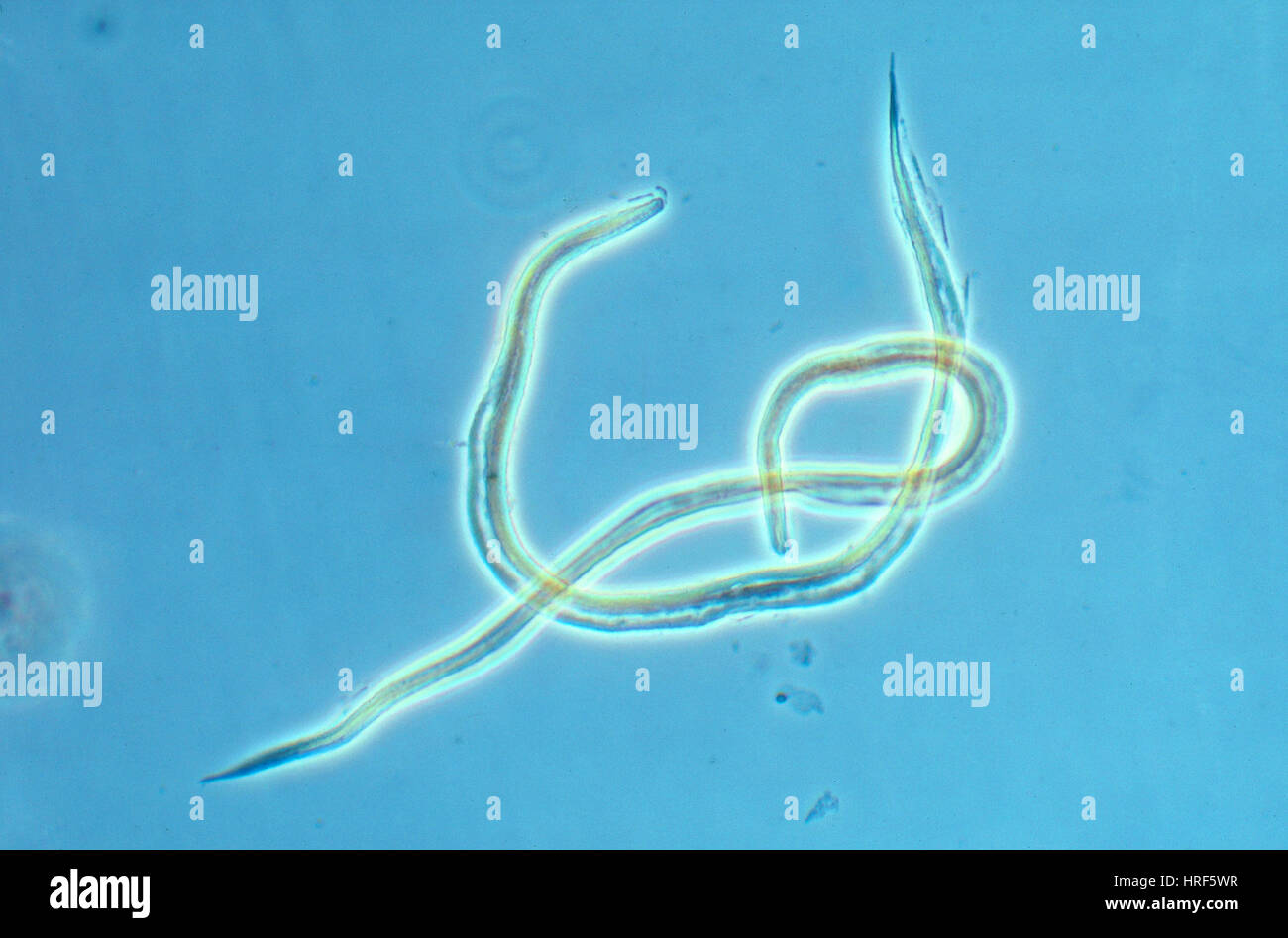 Hookworm Stock Photos & Hookworm Stock Images - Alamy
