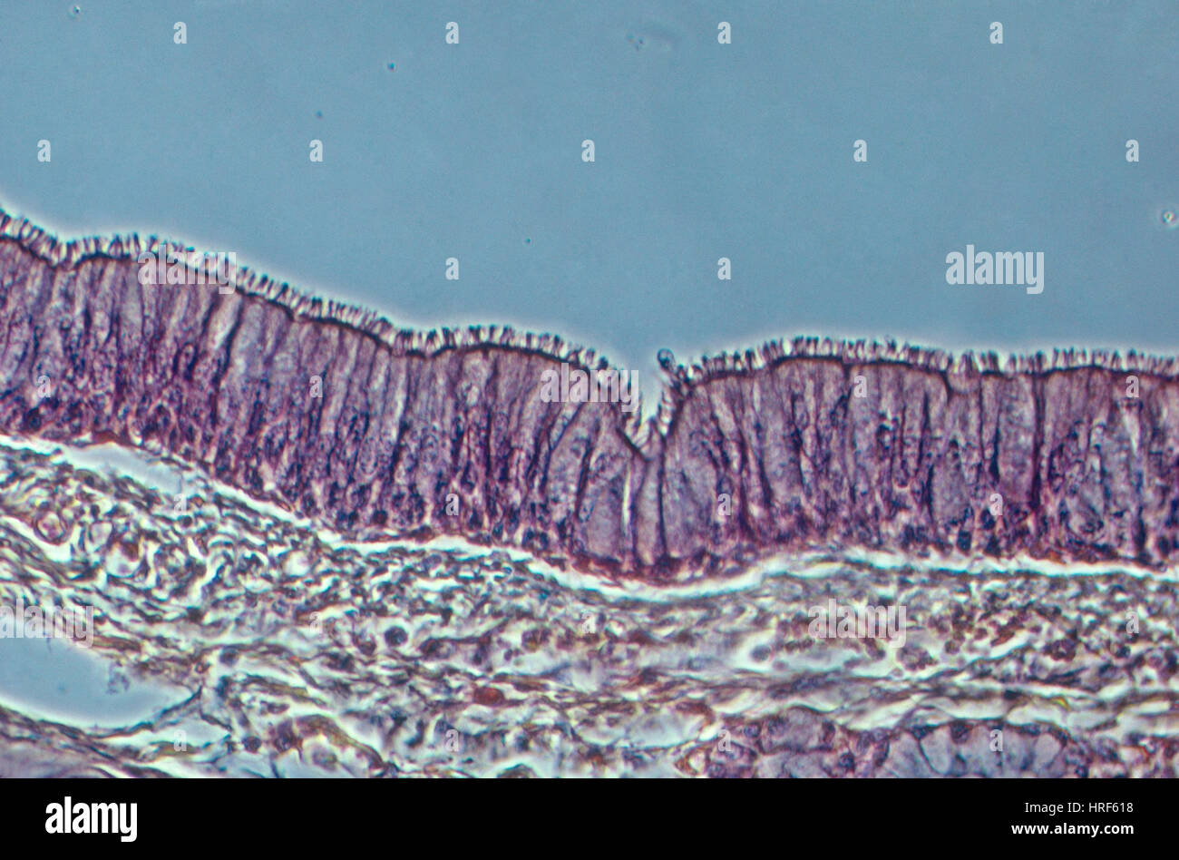 Ciliated columnar epithelium Stock Photo