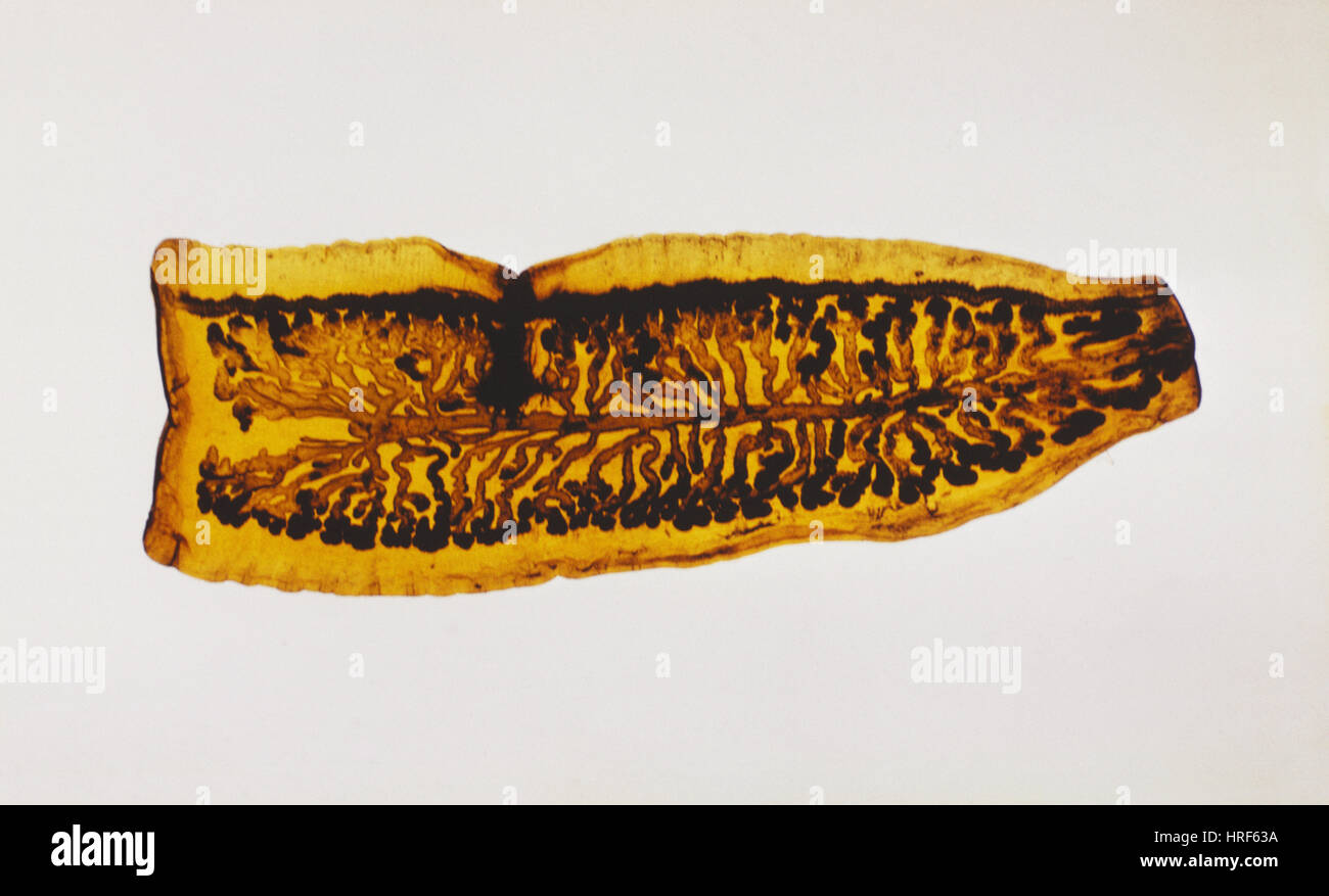 Beef Tapeworm (LM Stock Photo Alamy