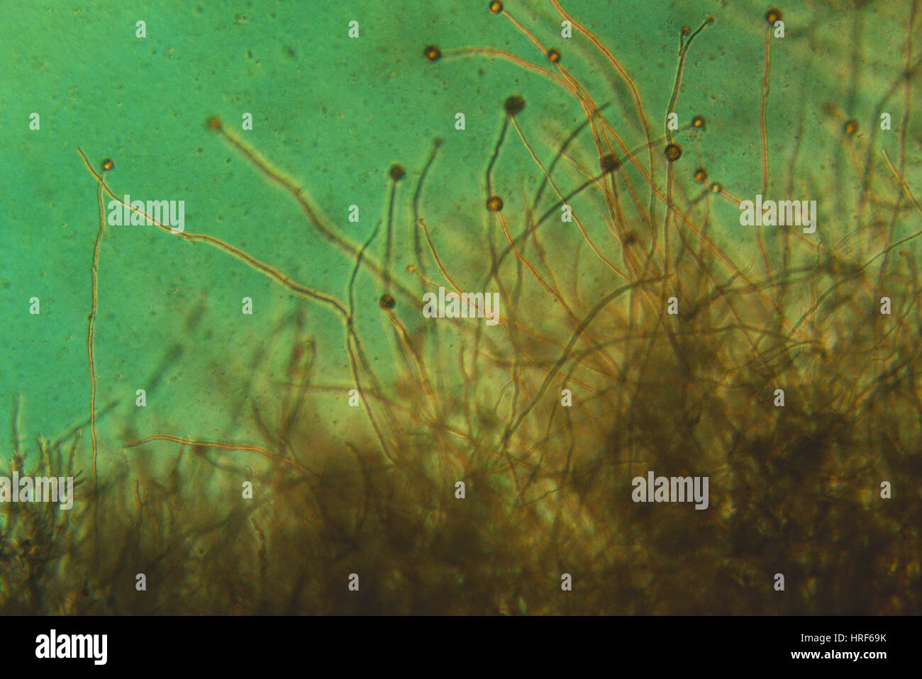 Potato Blight Mold (LM Stock Photo Alamy