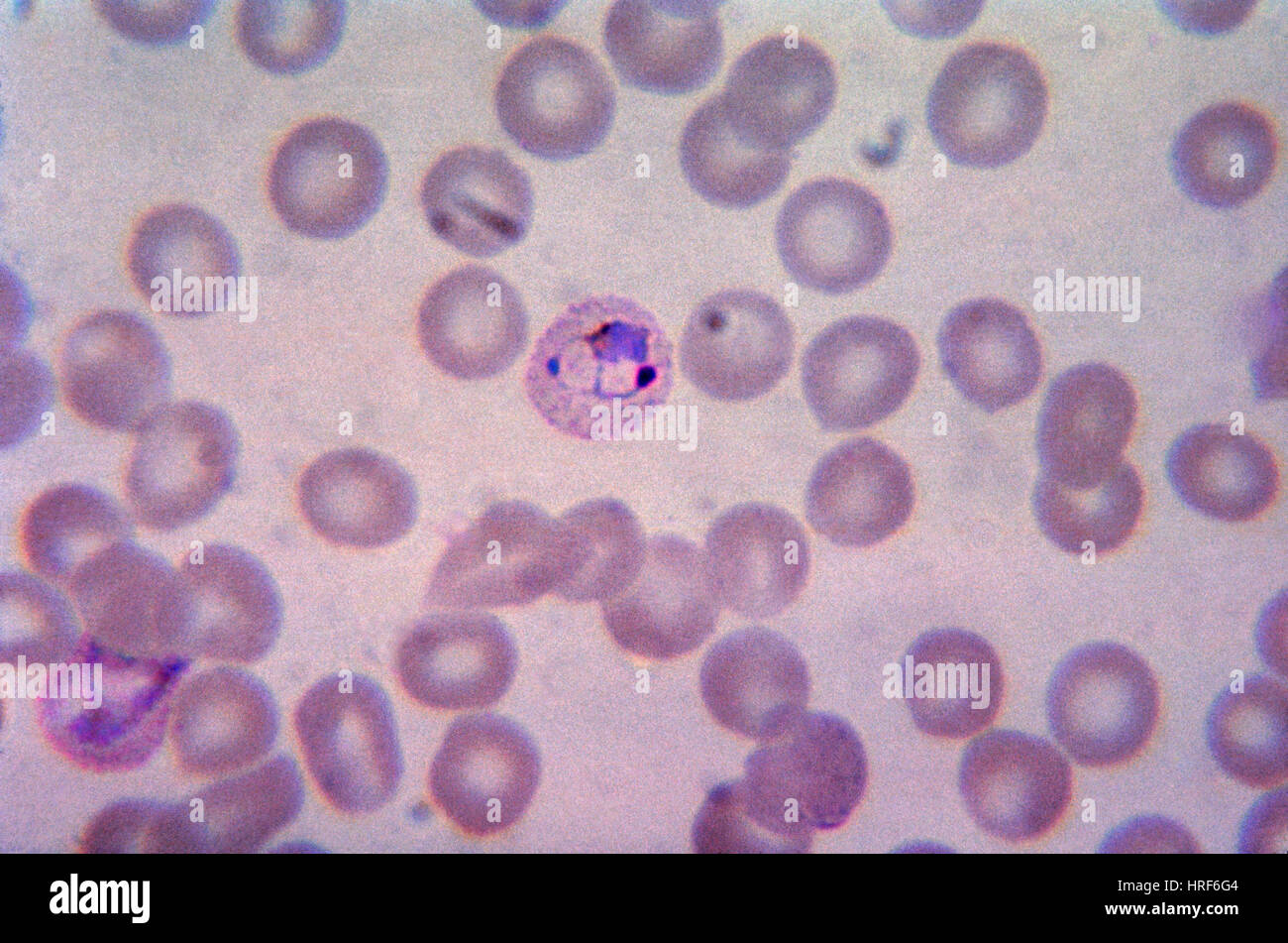 Schuffner's Dots (Malaria), LM Stock Photo