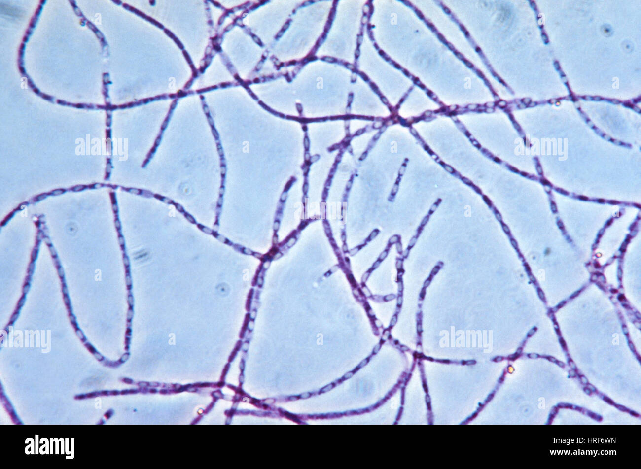 Bacillus anthracis Capsules, LM Stock Photo Alamy