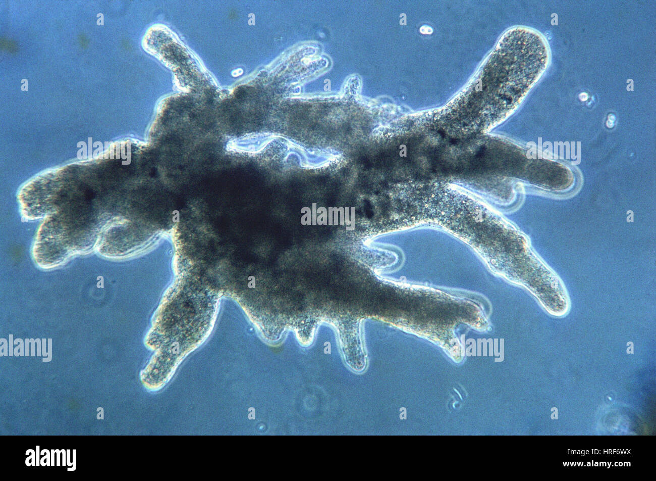 Protozoa, Amoeba, LM Stock Photo