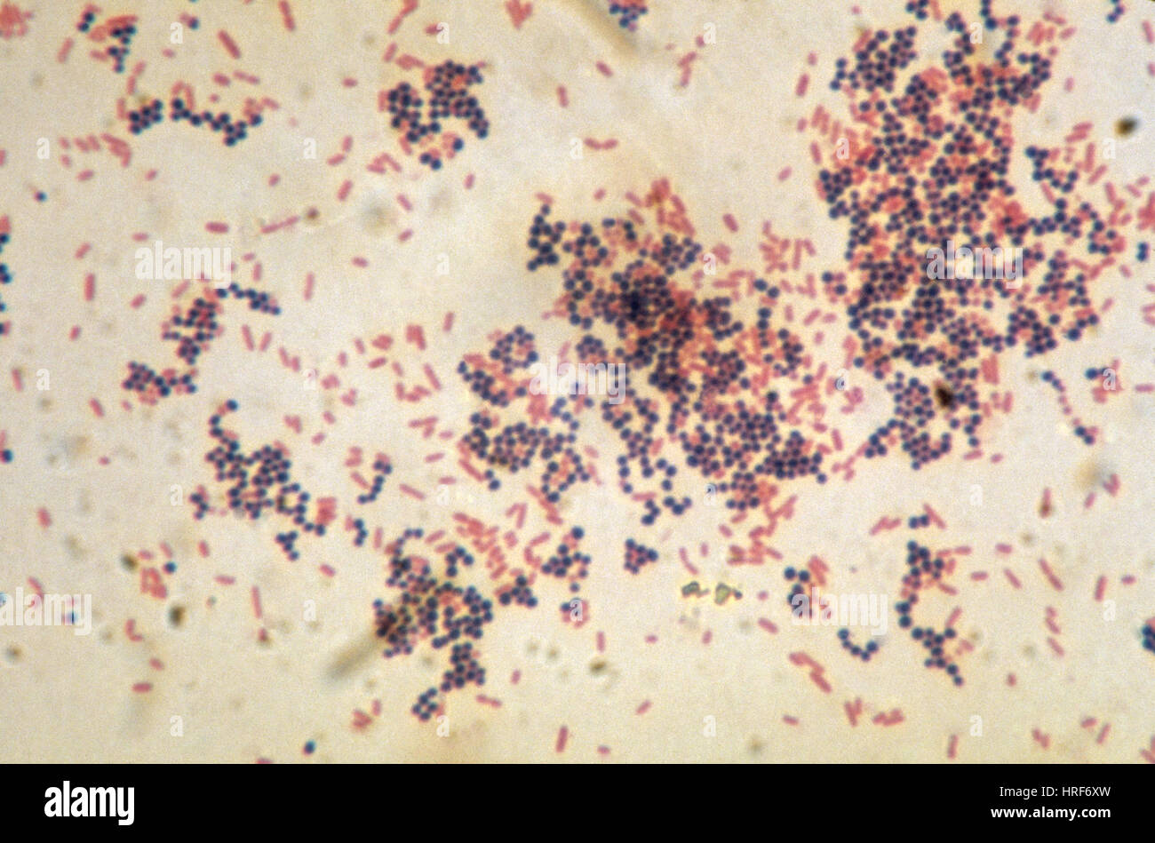 Escherichia coli and Staphylococcus aureus, LM Stock Photo
