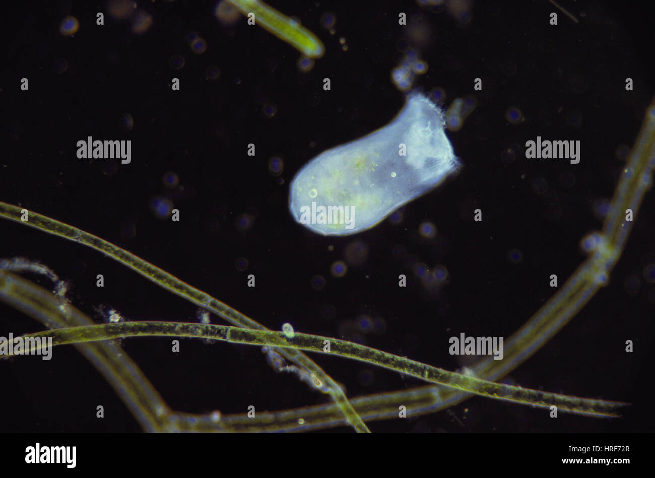 Stentor protozoan micrograph hi-res stock photography and images - Alamy
