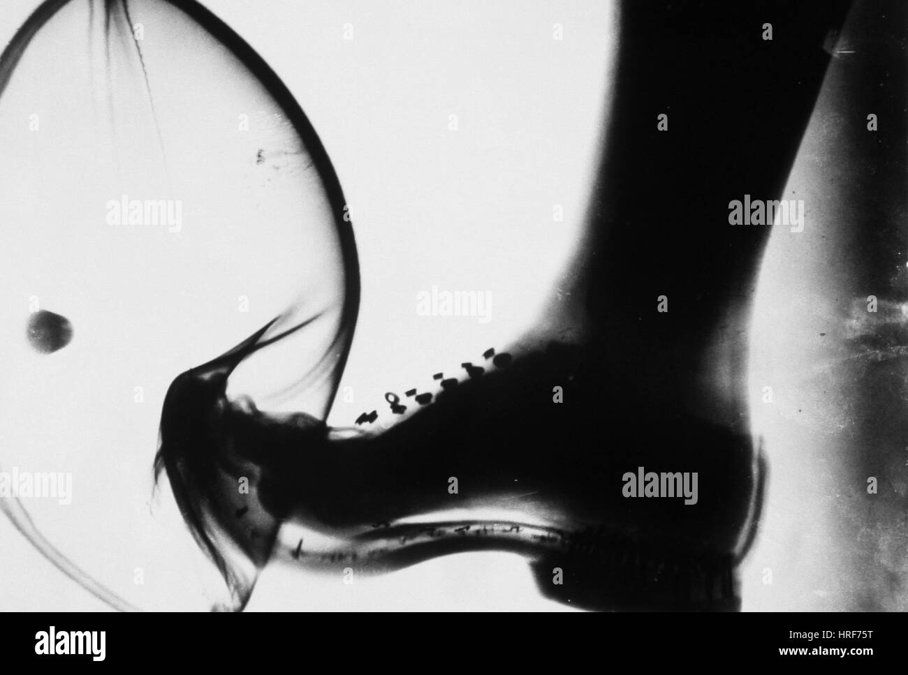 Kicking a Ball, X-ray Stock Photo - Alamy