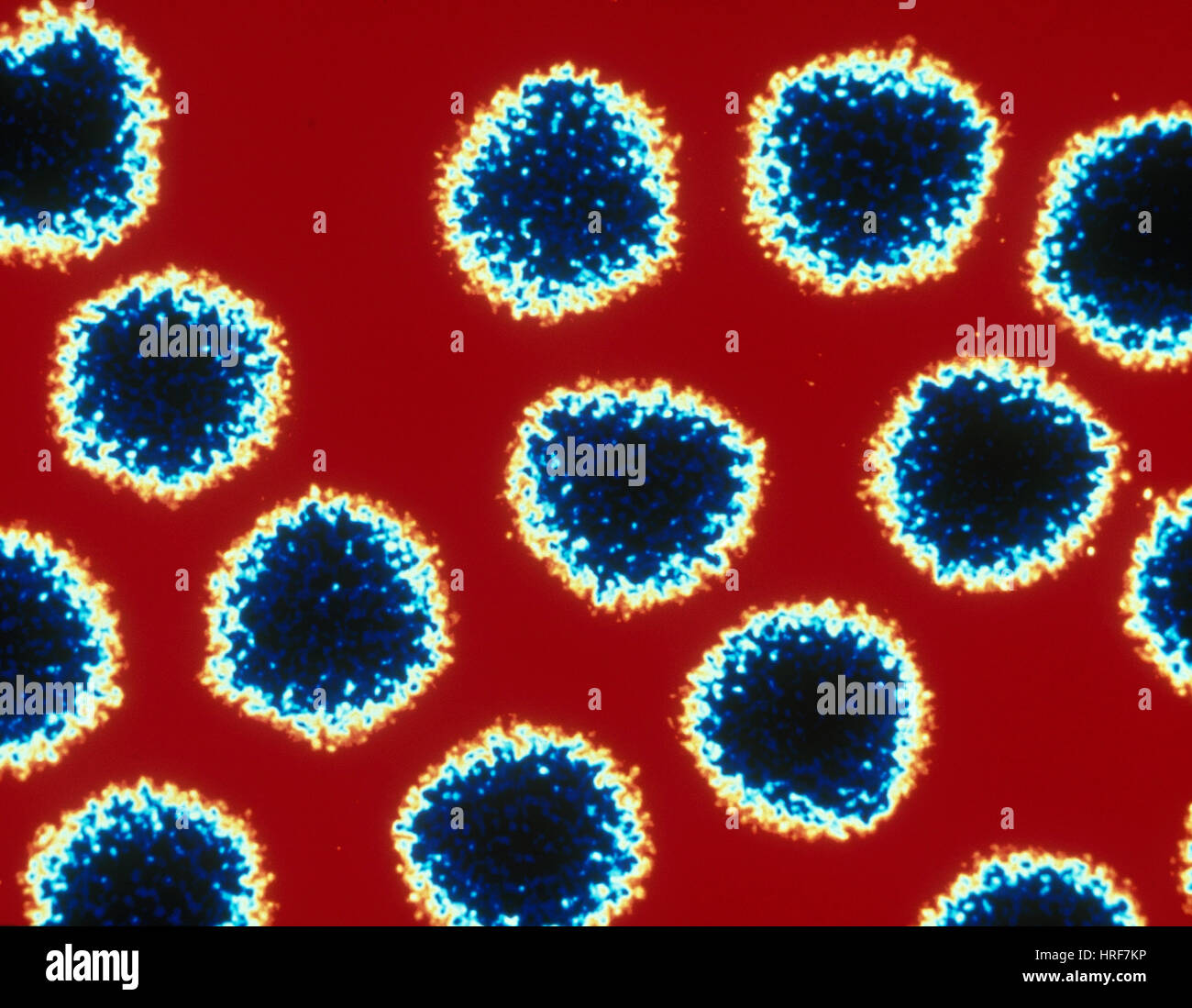 Adenovirus (TEM) Stock Photo