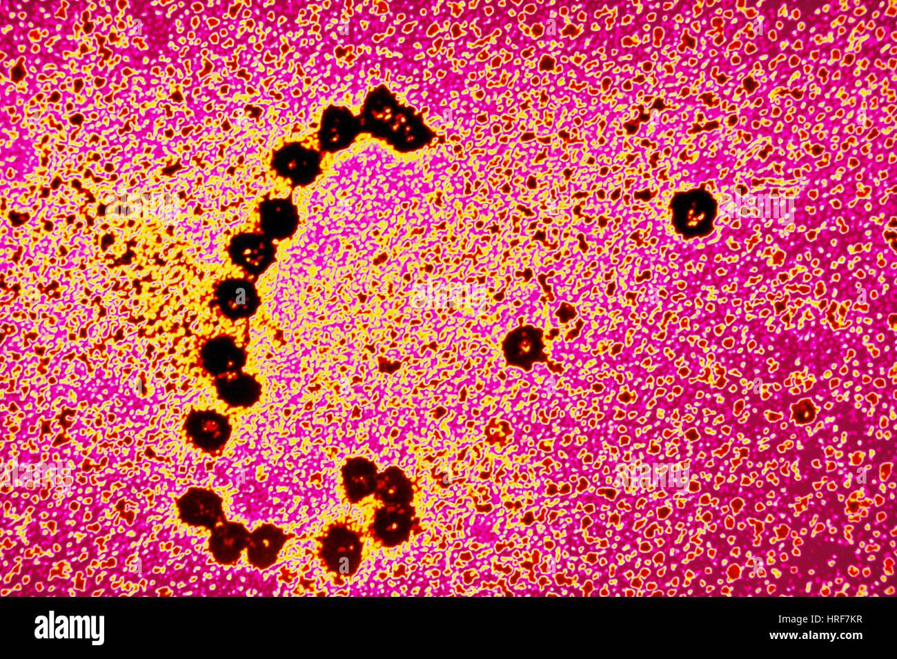 Ribosomes translating RNA strand Stock Photo