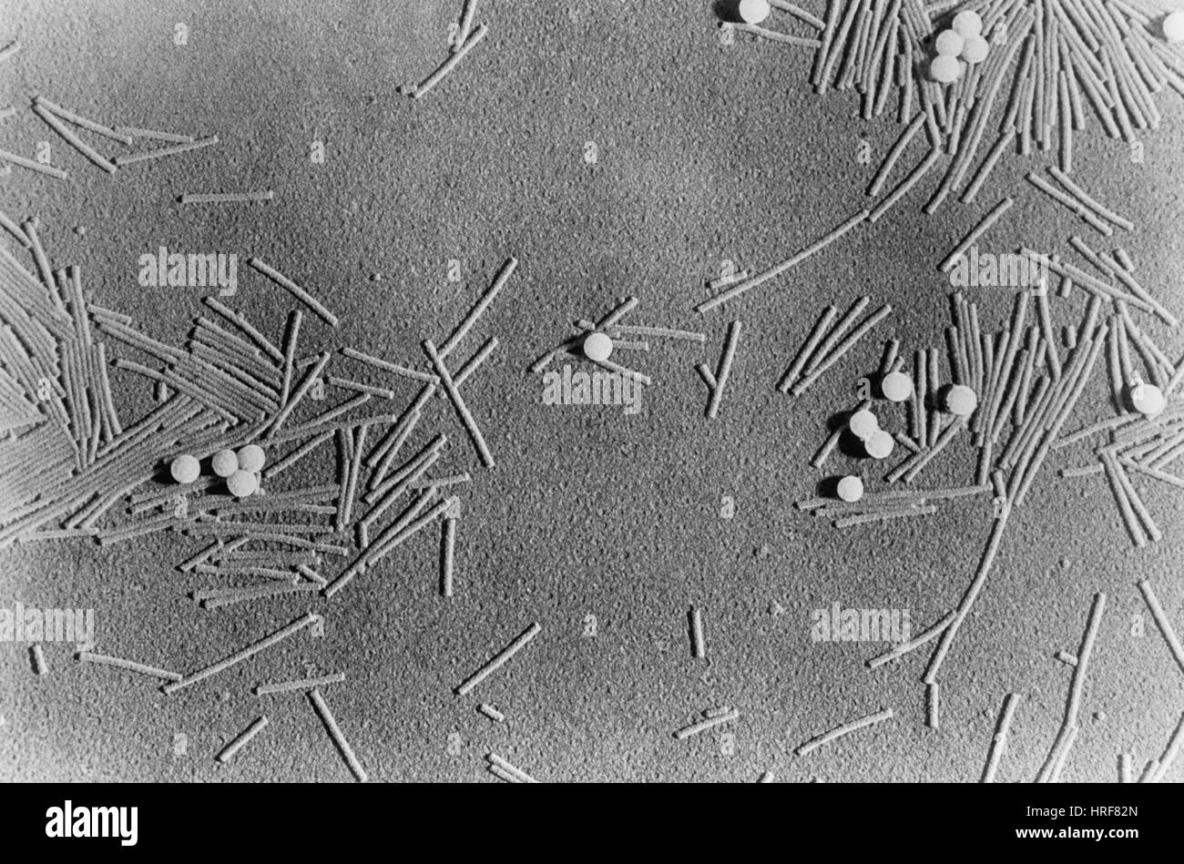 Tobacco Mosaic Virus Under Microscope