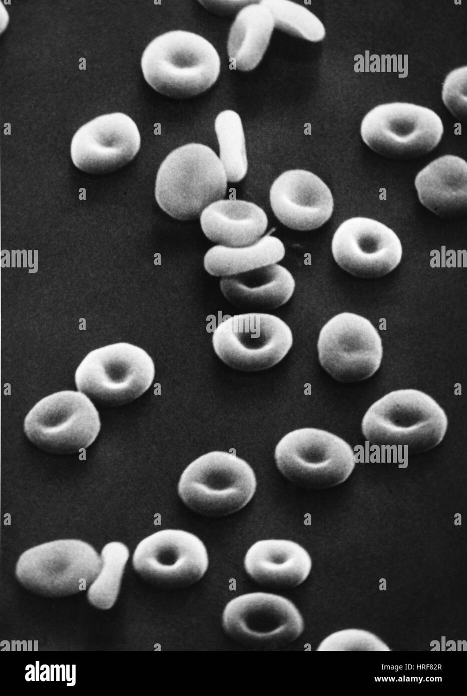 Red blood cells, SEM Stock Photo Alamy