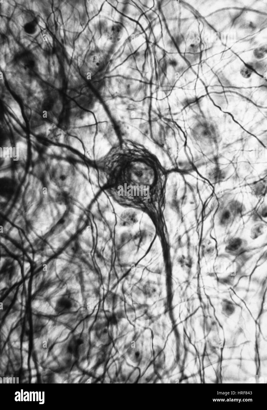 Electron micrograph neuron hi-res stock photography and images - Alamy
