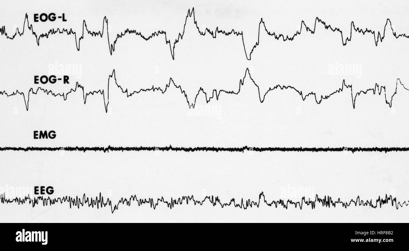 Polygraph Tracings of REM Sleep Stock Photo Alamy