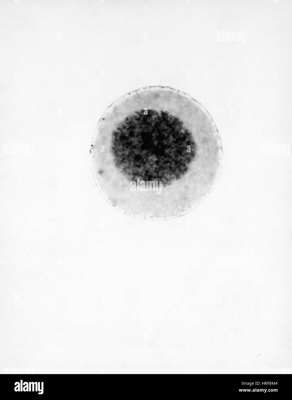 Interphase hi-res stock photography and images - Alamy