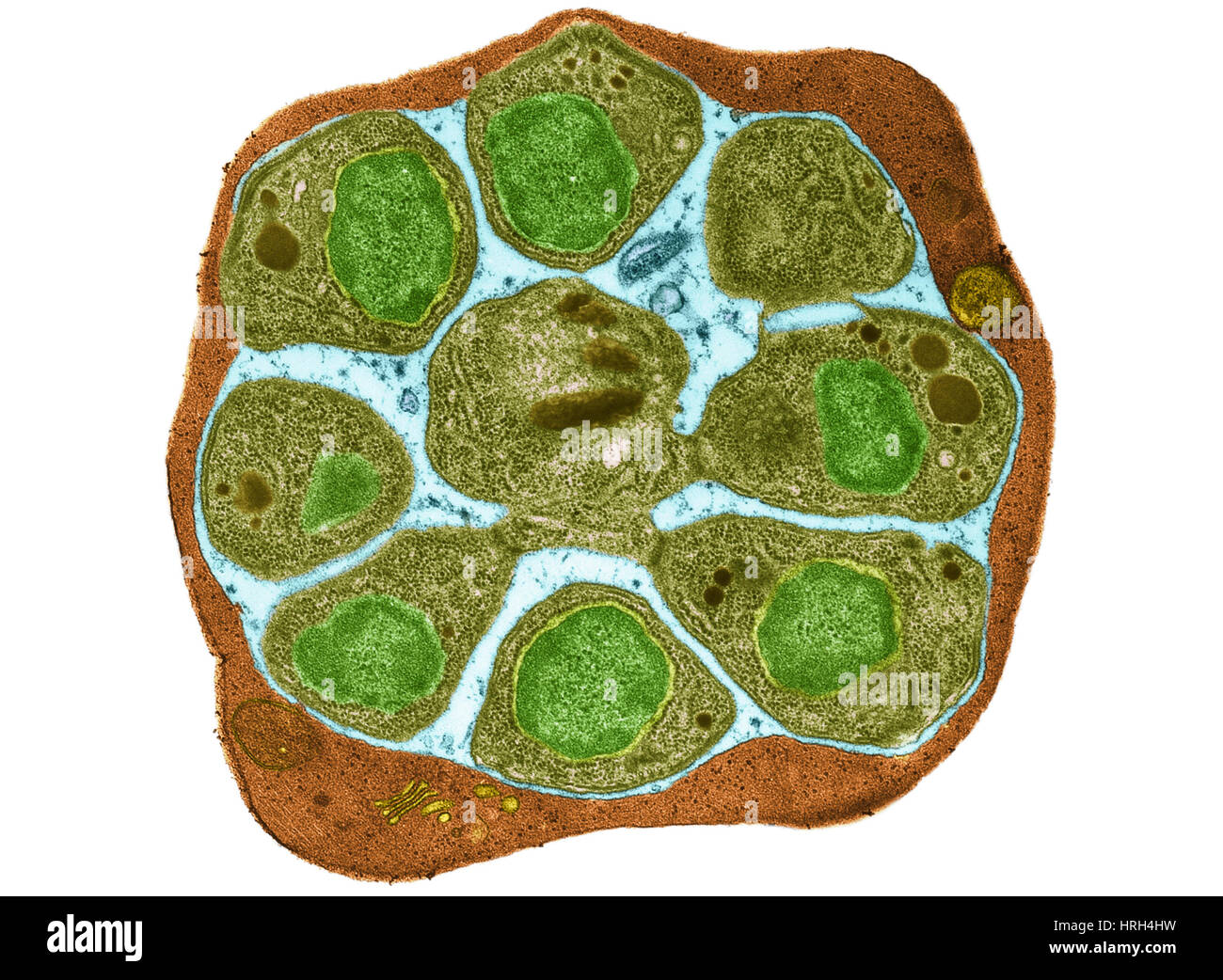 Malaria parasite in blood cell, TEM Stock Photo