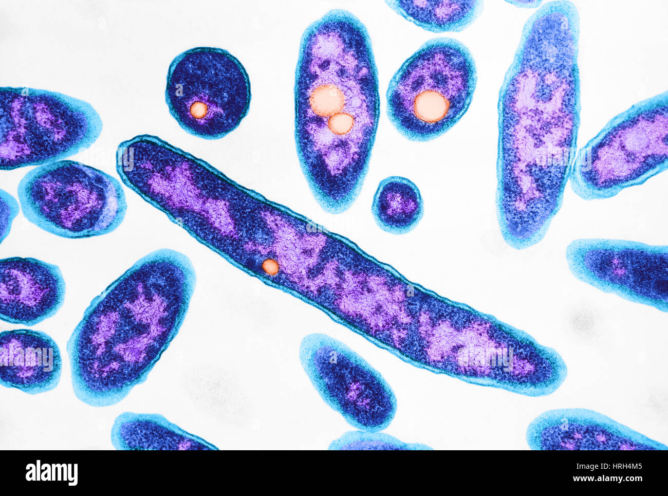 Legionnaires' disease bacteria Stock Photo Alamy