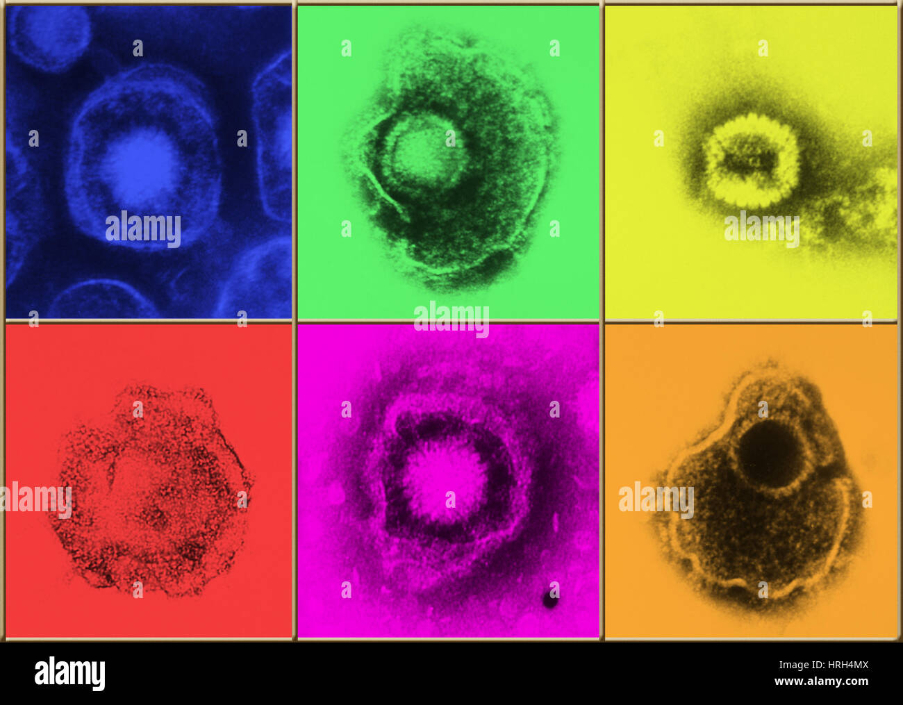 Various forms of herpes simplex virus Stock Photo Alamy