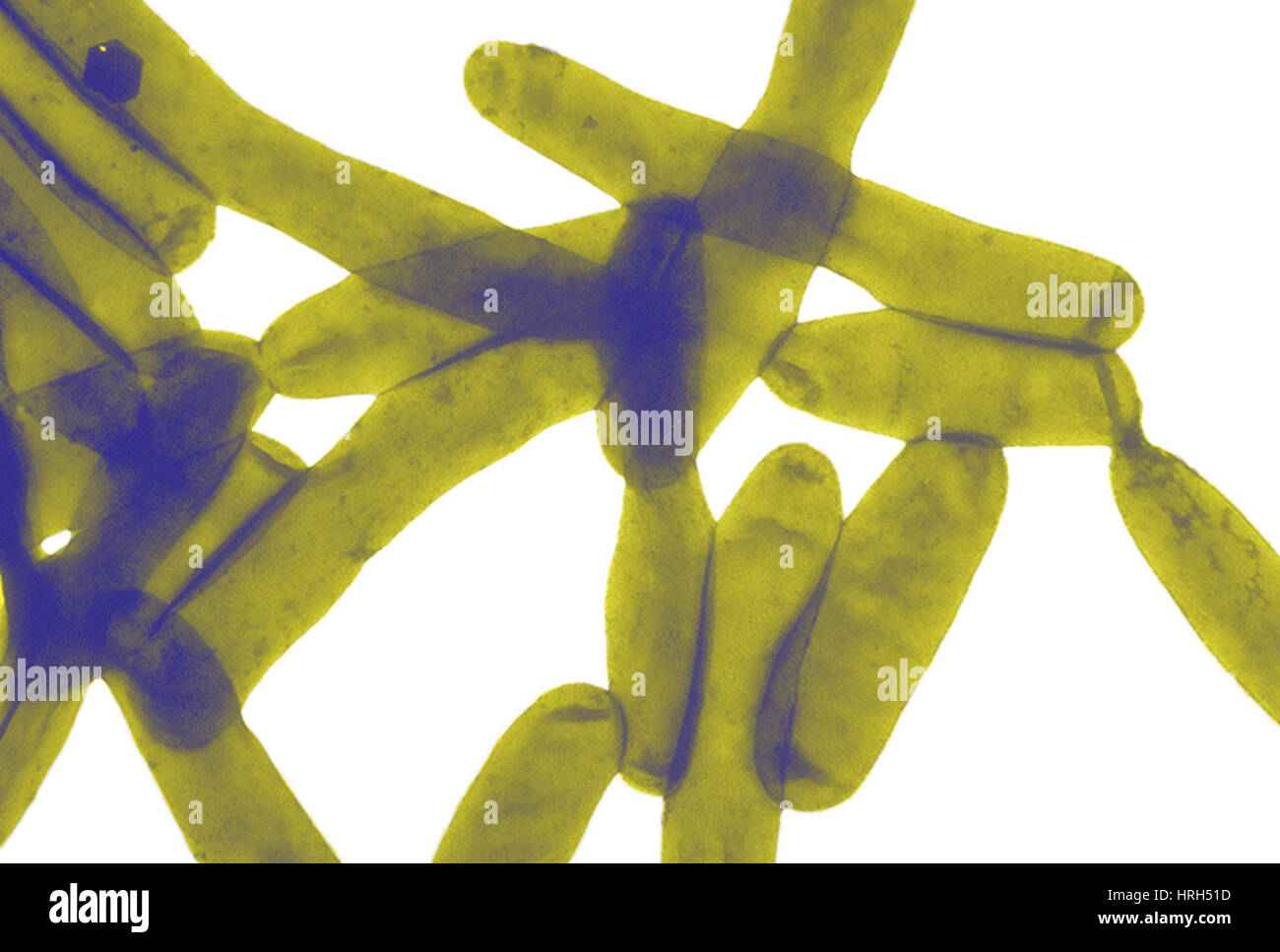 Legionella bacterium hires stock photography and images Alamy