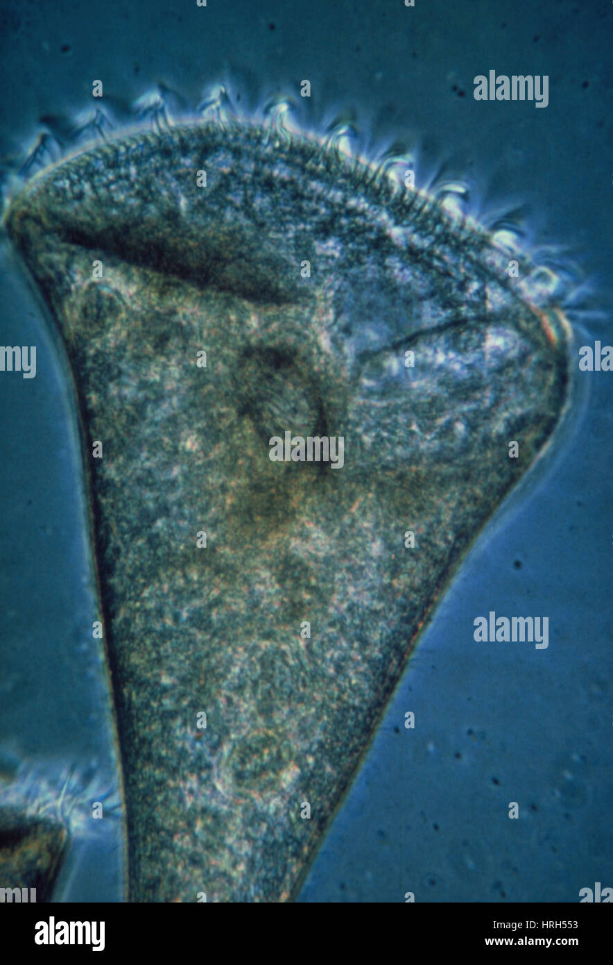 LM of Stentor sp., a ciliate protozoan Stock Photo