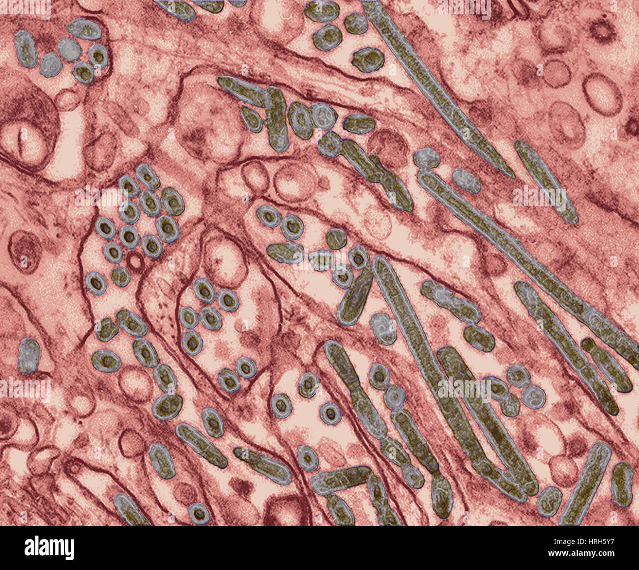 Avian influenza micrograph hi-res stock photography and images - Alamy