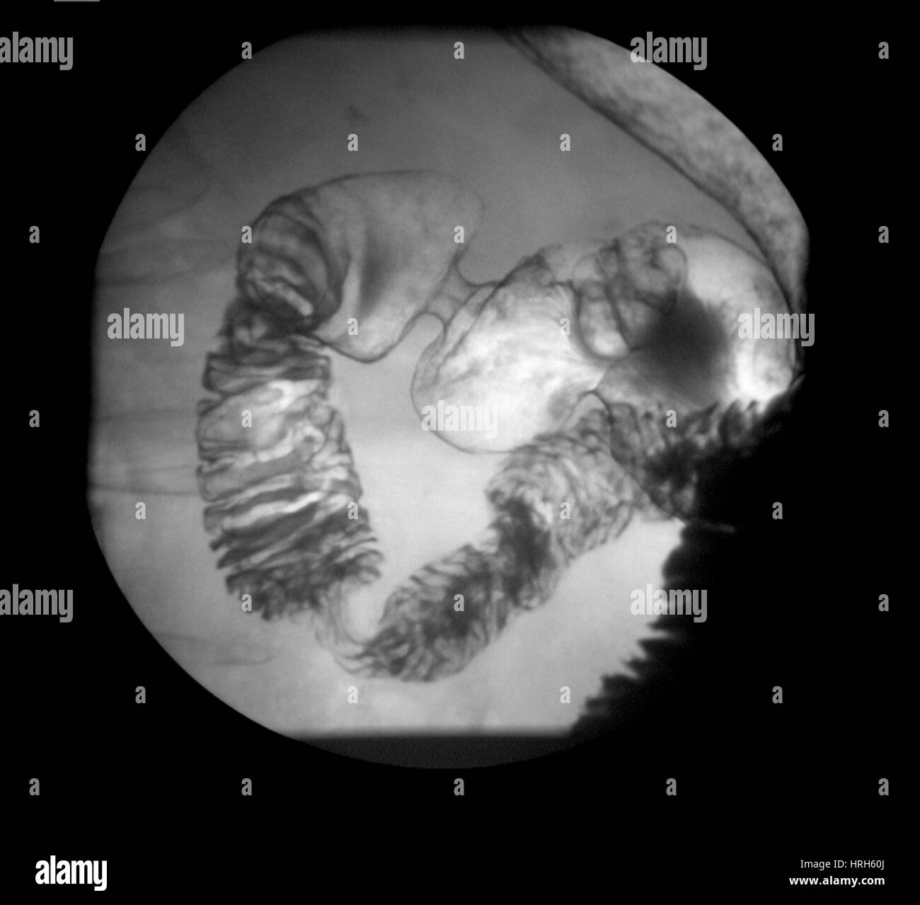 Stomach xray normal hires stock photography and images Alamy