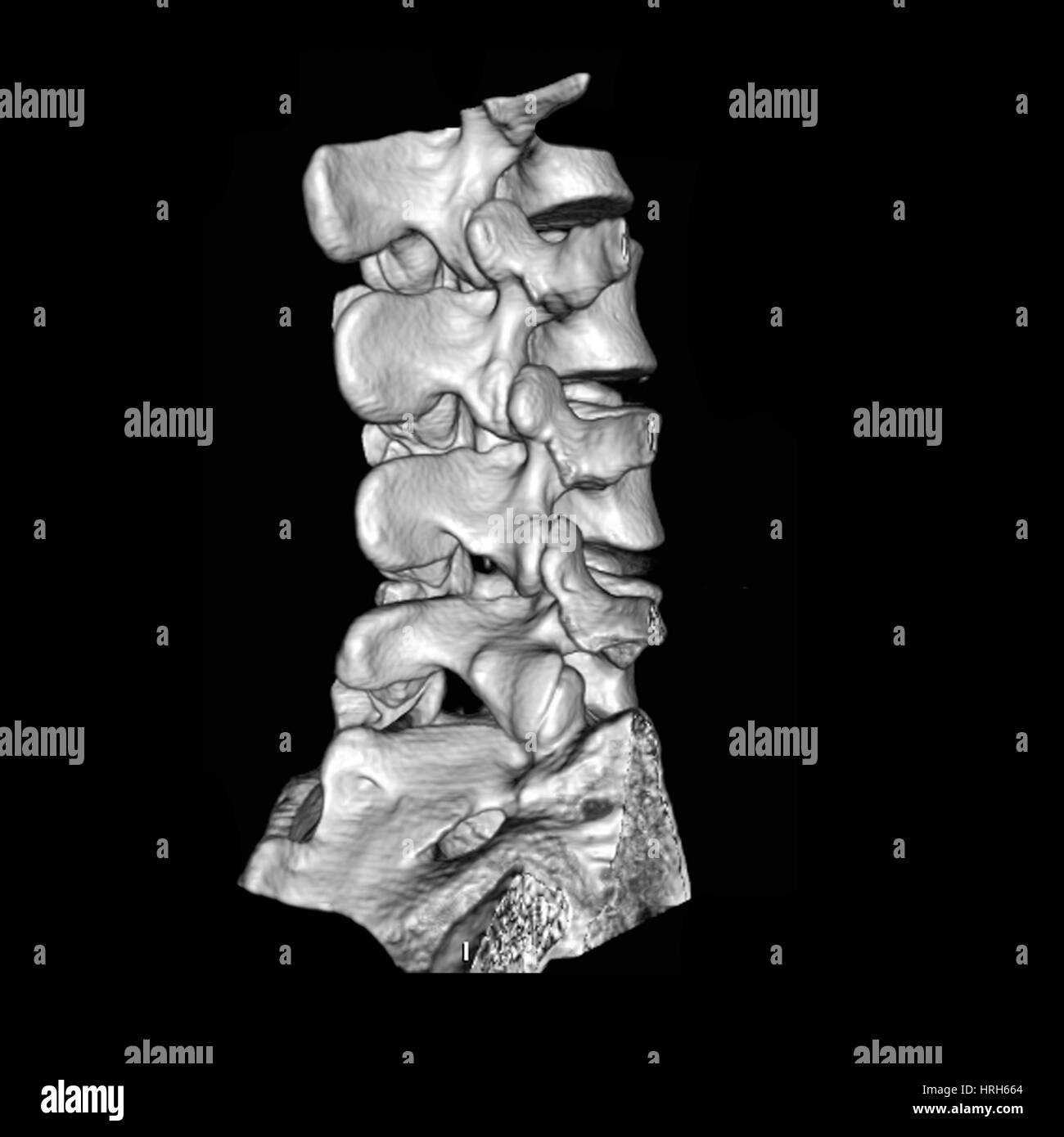 View of Lumbar Spine Stock Photo