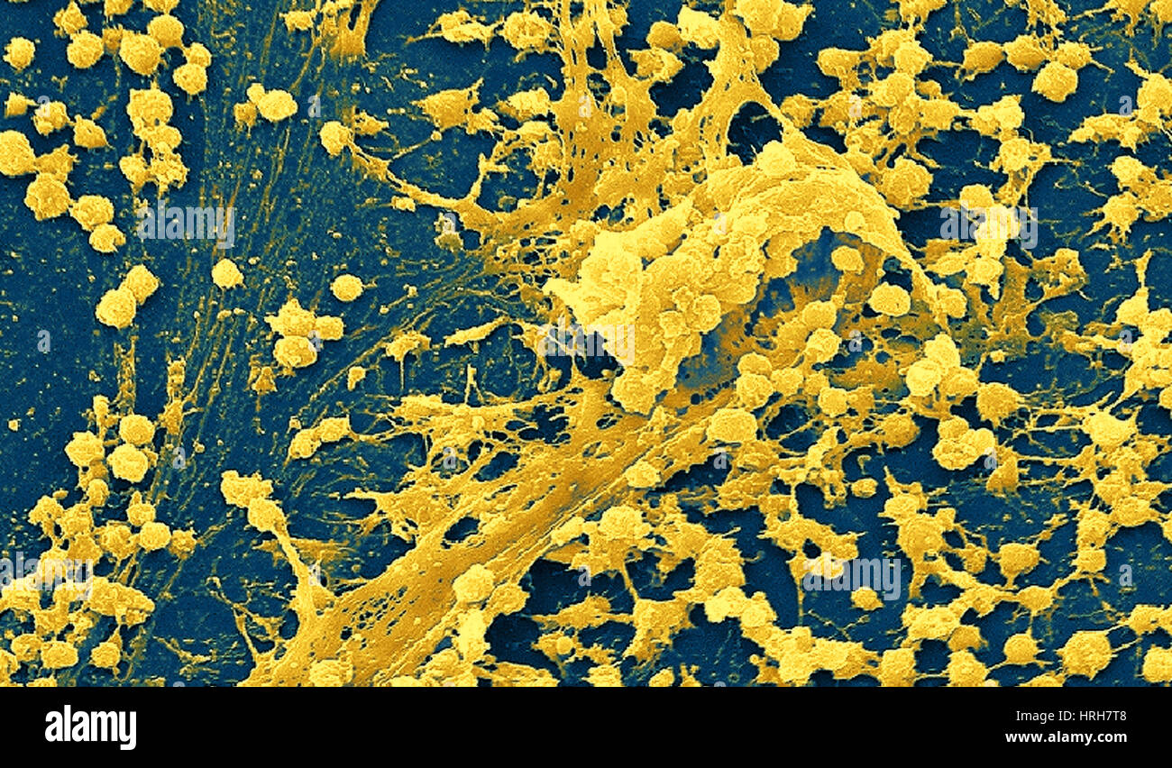 Biofilm sem hi-res stock photography and images - Alamy
