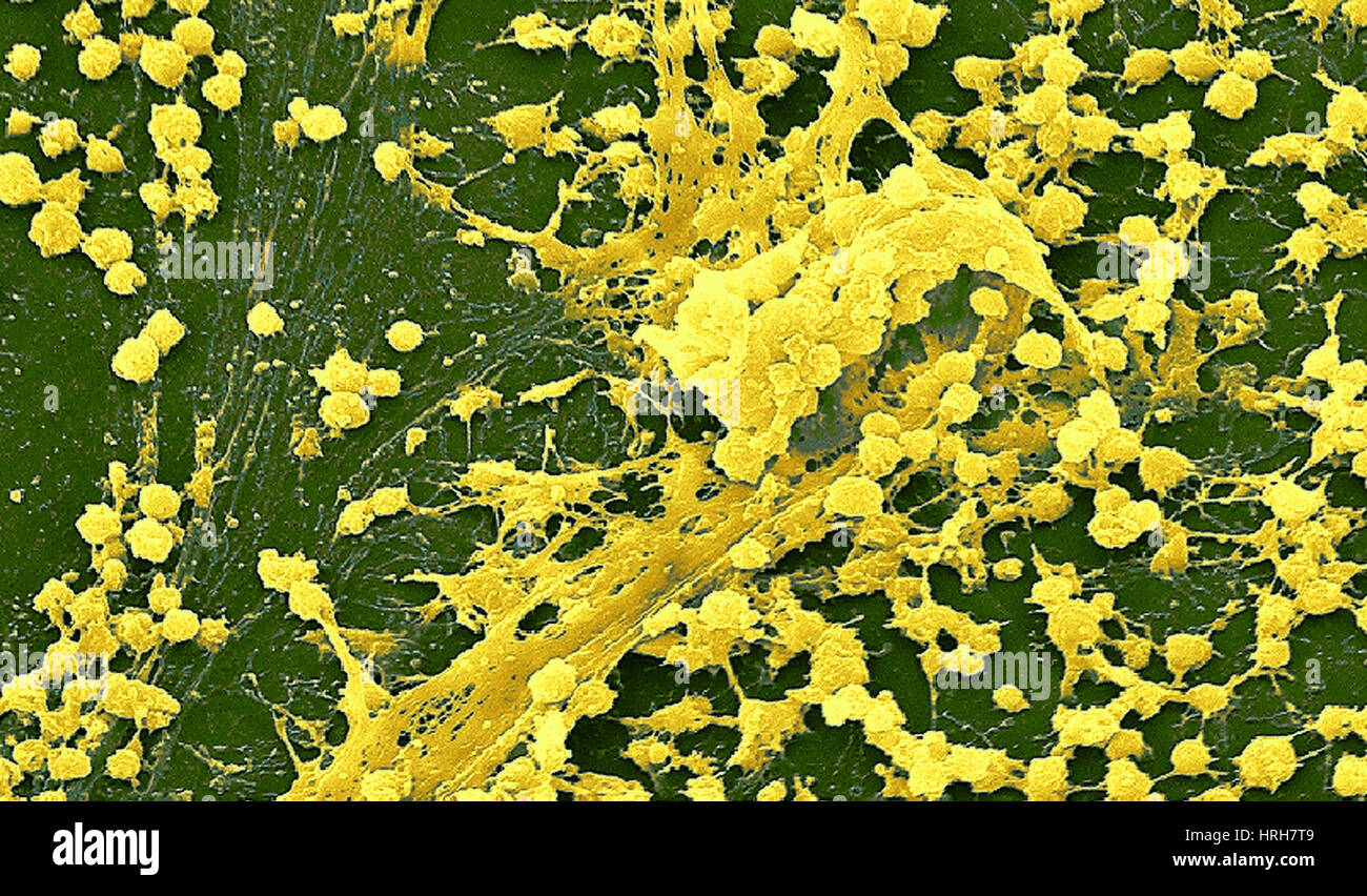 Biofilm bacteria hi-res stock photography and images - Alamy