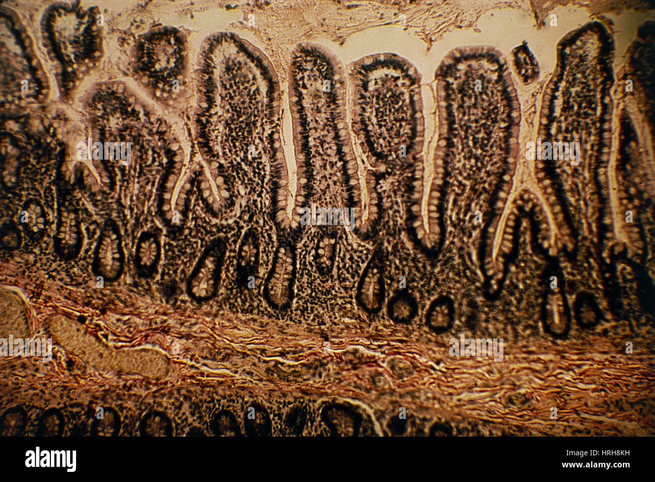 LM of a section through the human intestinal wall Stock Photo
