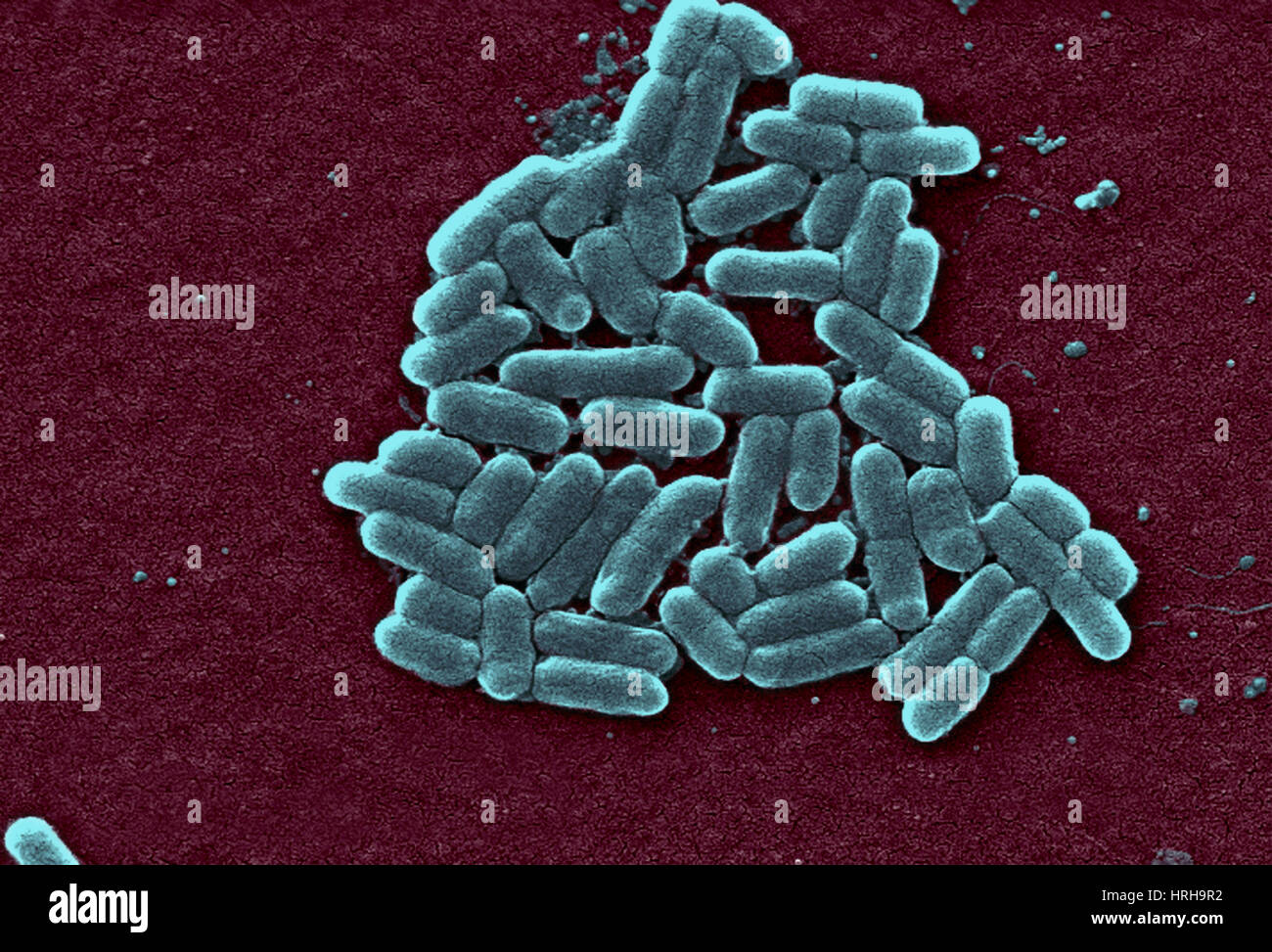 Escherichia coli O157:H7 Bacteria, SEM Stock Photo