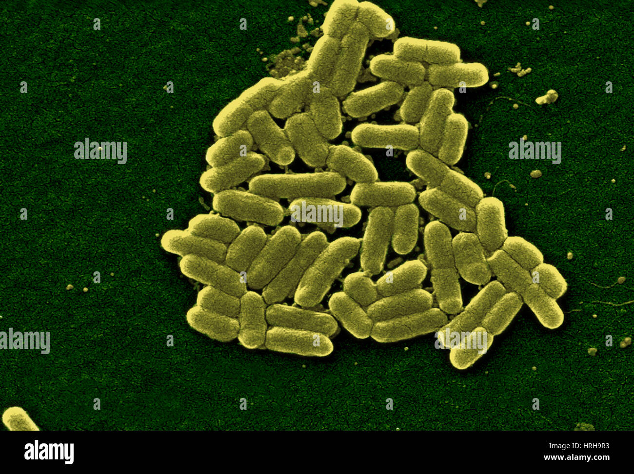 Escherichia coli O157:H7 Bacteria, SEM Stock Photo