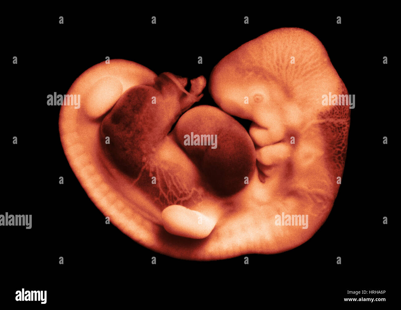35 day old human embryo Stock Photo