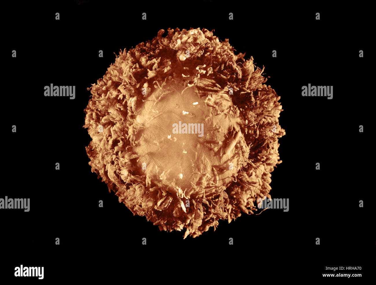 28 day old human embryo Stock Photo