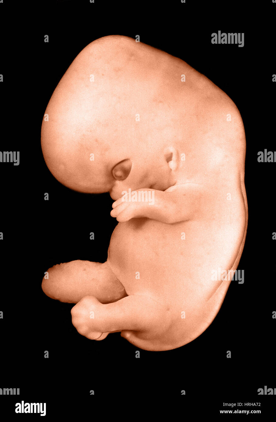 44 day old human embryo Stock Photo